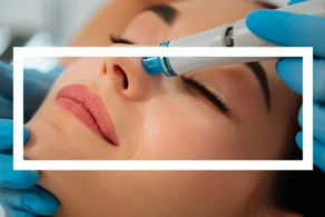 Hidrafacial: O tratamento que vai renovar o seu rosto