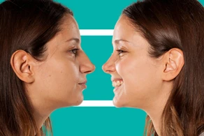 Mitos e Verdades sobre a Rinoplastia: O que Você Precisa Saber