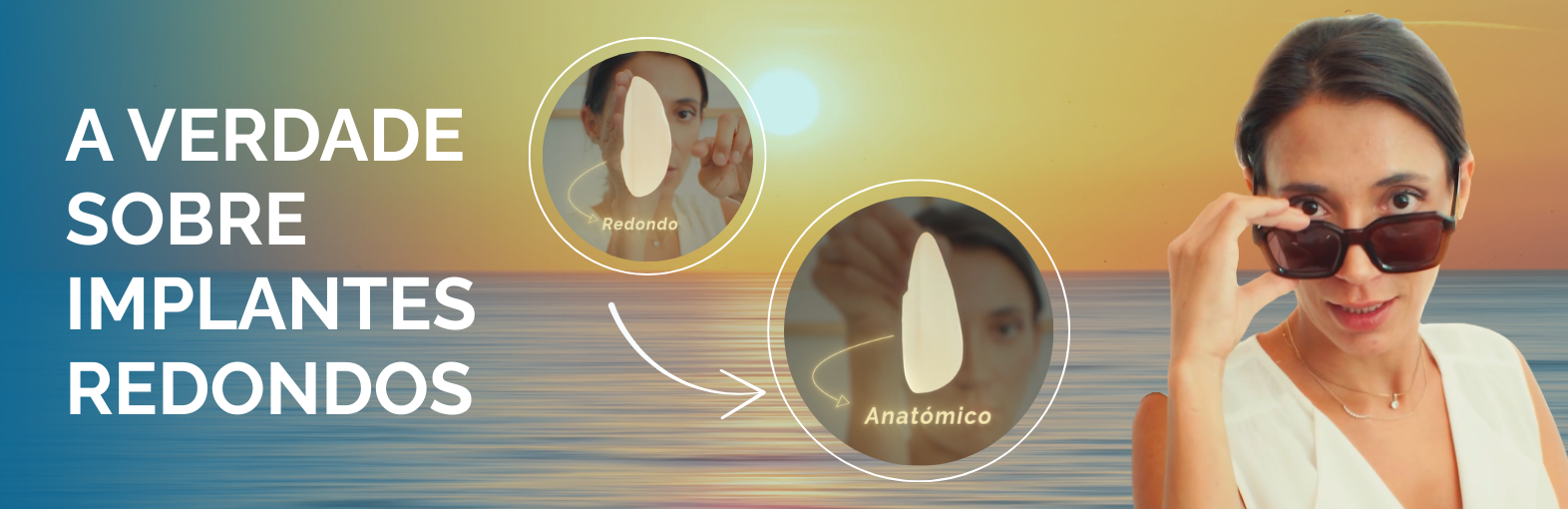 A verdade sobre os implantes redondos (E por que motivo preferimos os anatómicos)